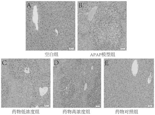 Application of water extract of gomphrena globose to preparation of drugs used for treating acute liver injury of mice