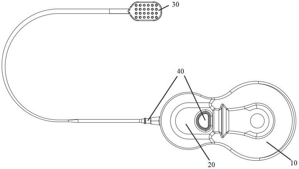 An artificial retinal implant