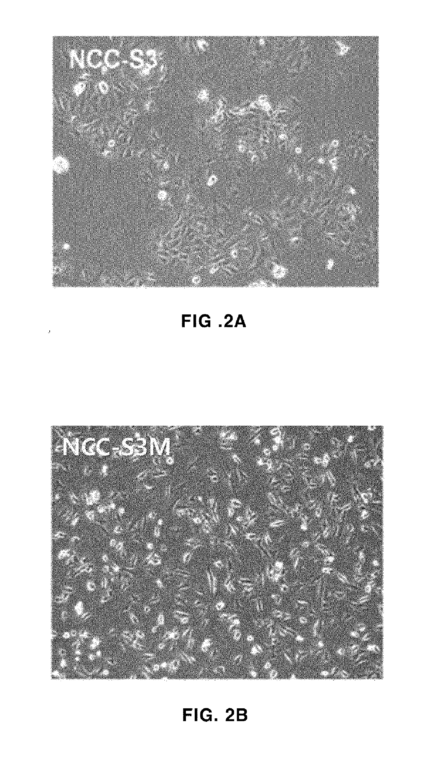 Gastric cancer cell line derived from murine gastric adenocarcinoma lacking p53 and e-cadherin and use thereof