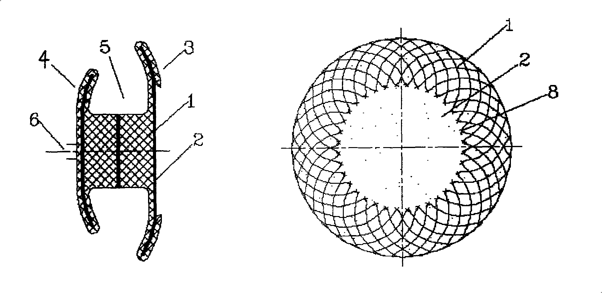 Blockage capable of reducing the thrombus source