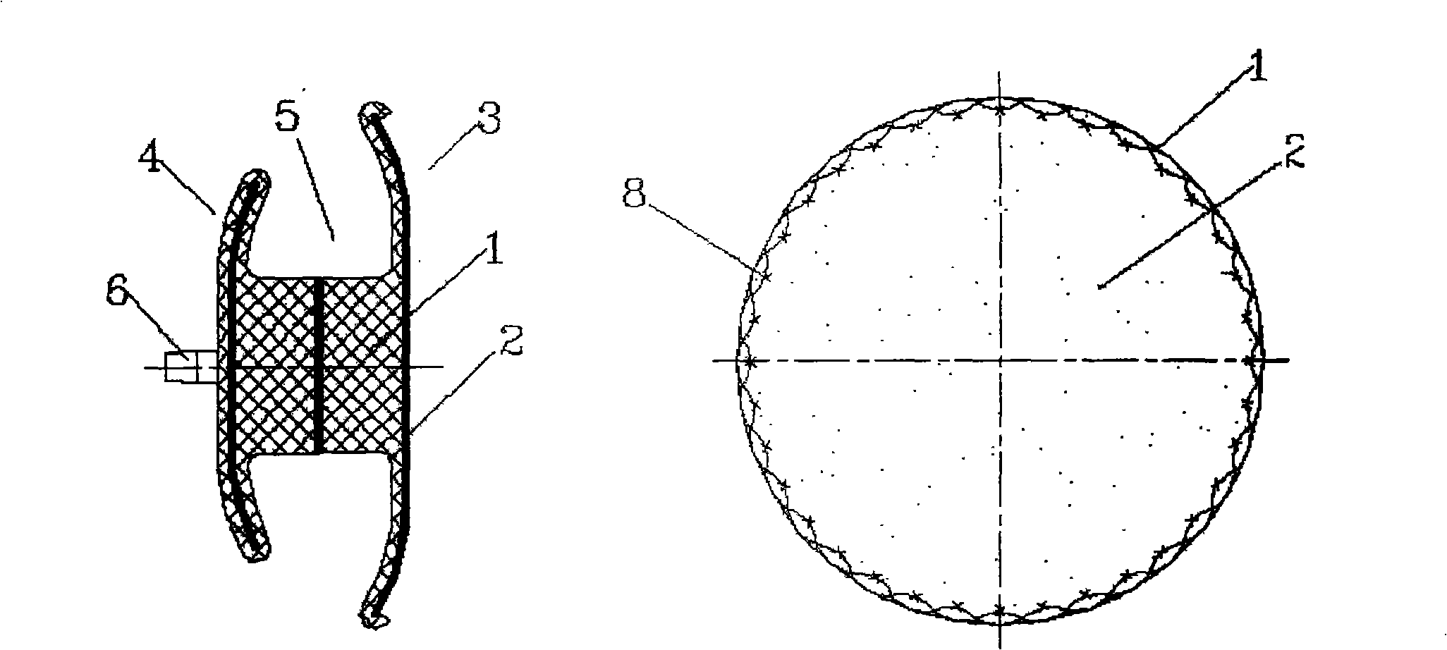 Blockage capable of reducing the thrombus source