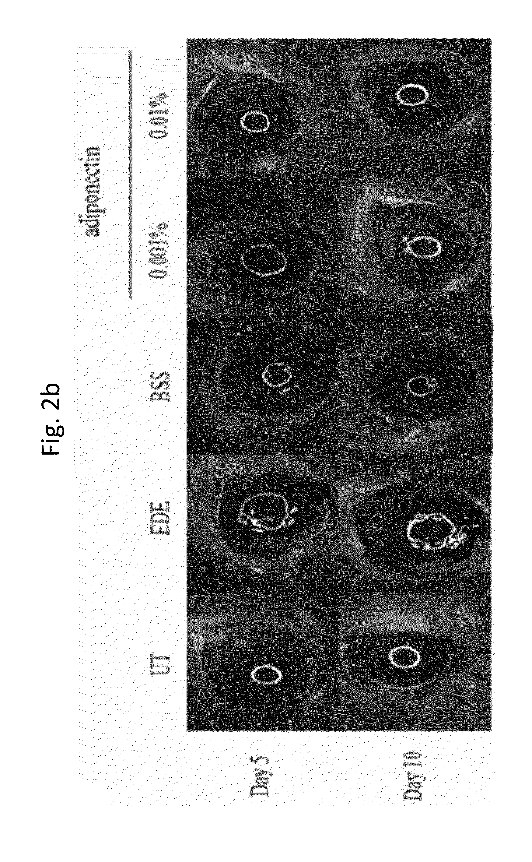 Methods for preventing or treating eye diseases using adiponectin