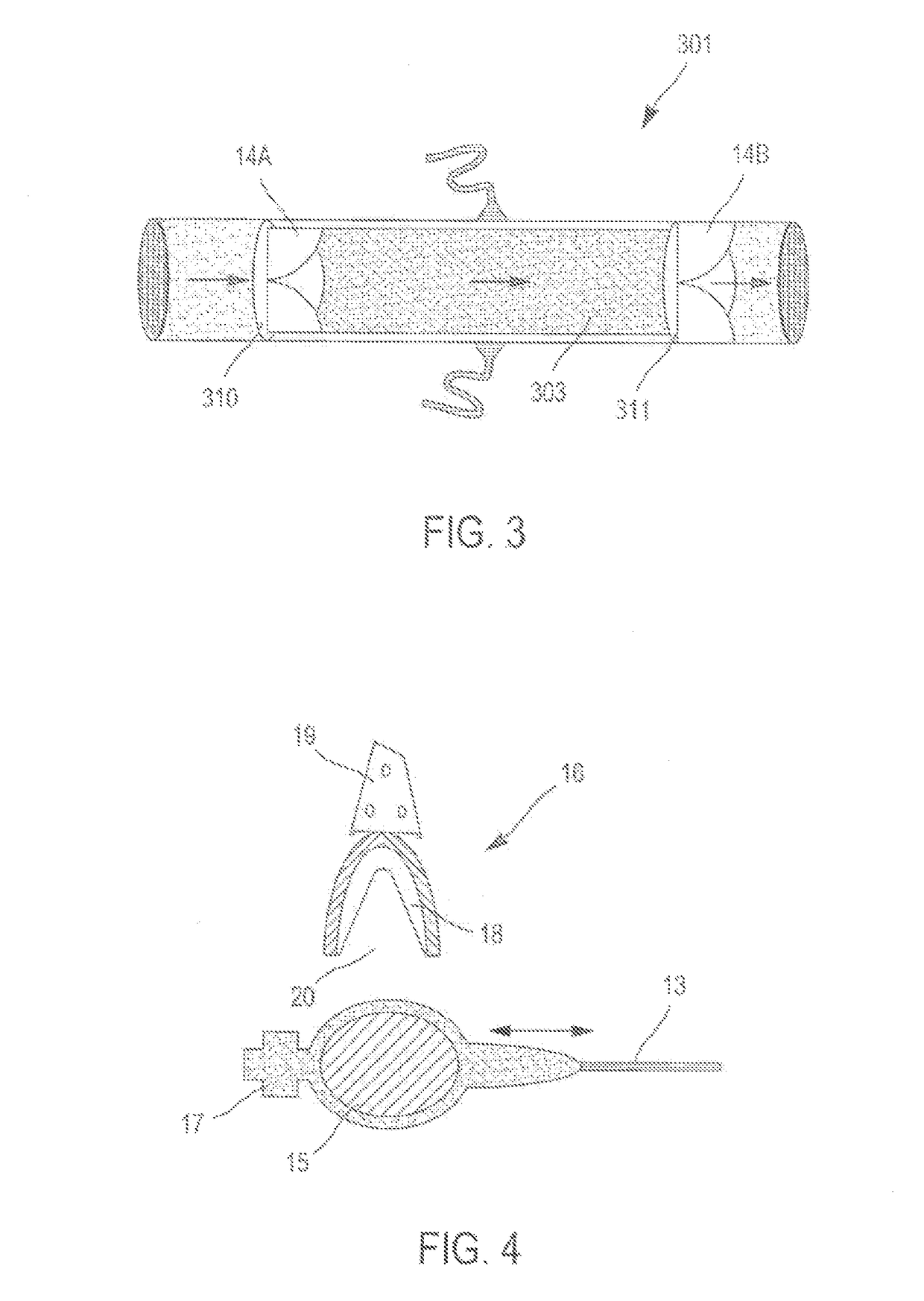 Pulsatile medical device designed to be used in extracorporeal surgery