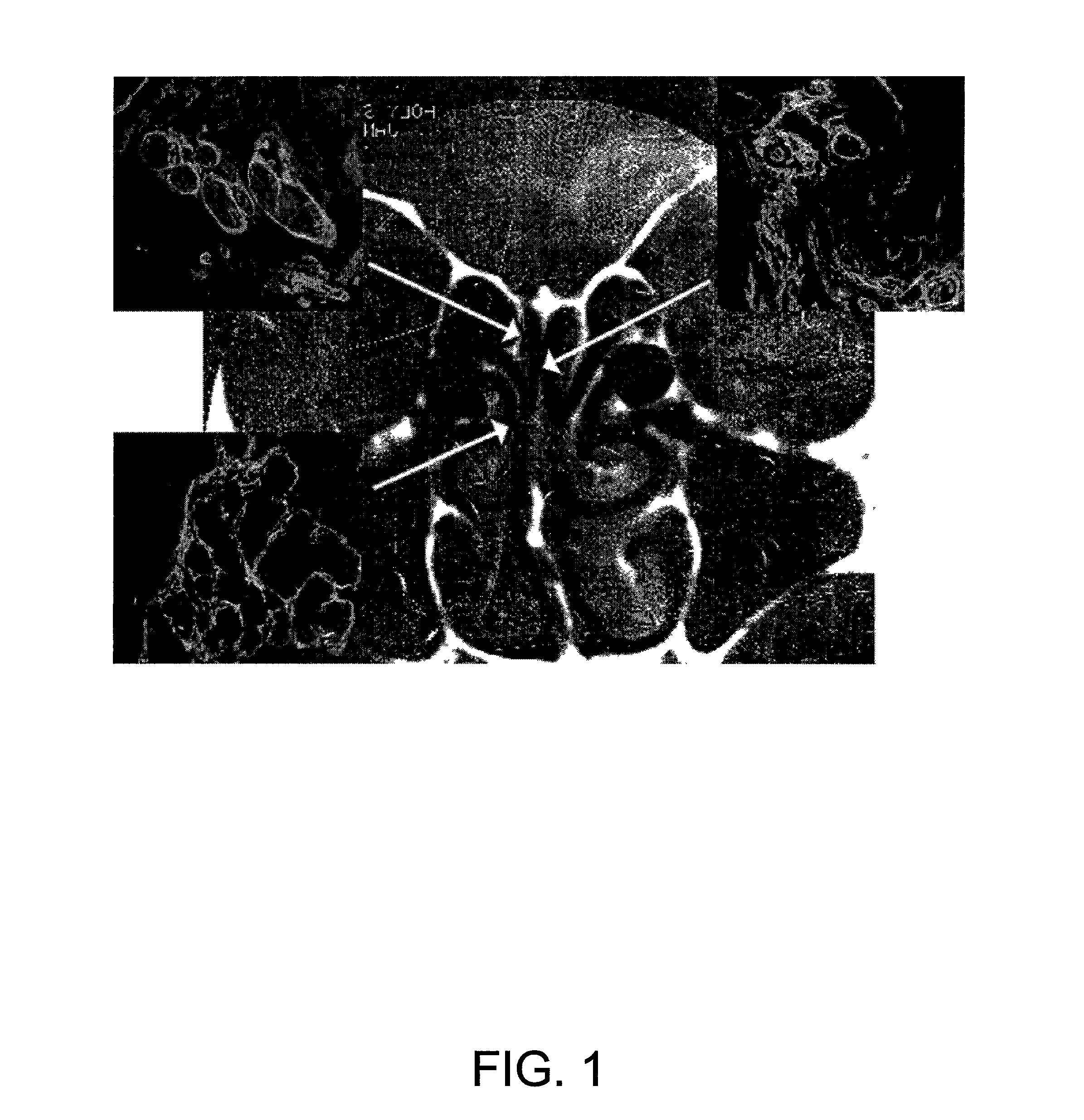 Methods of preparing olfactory ensheathing cells for transplantation