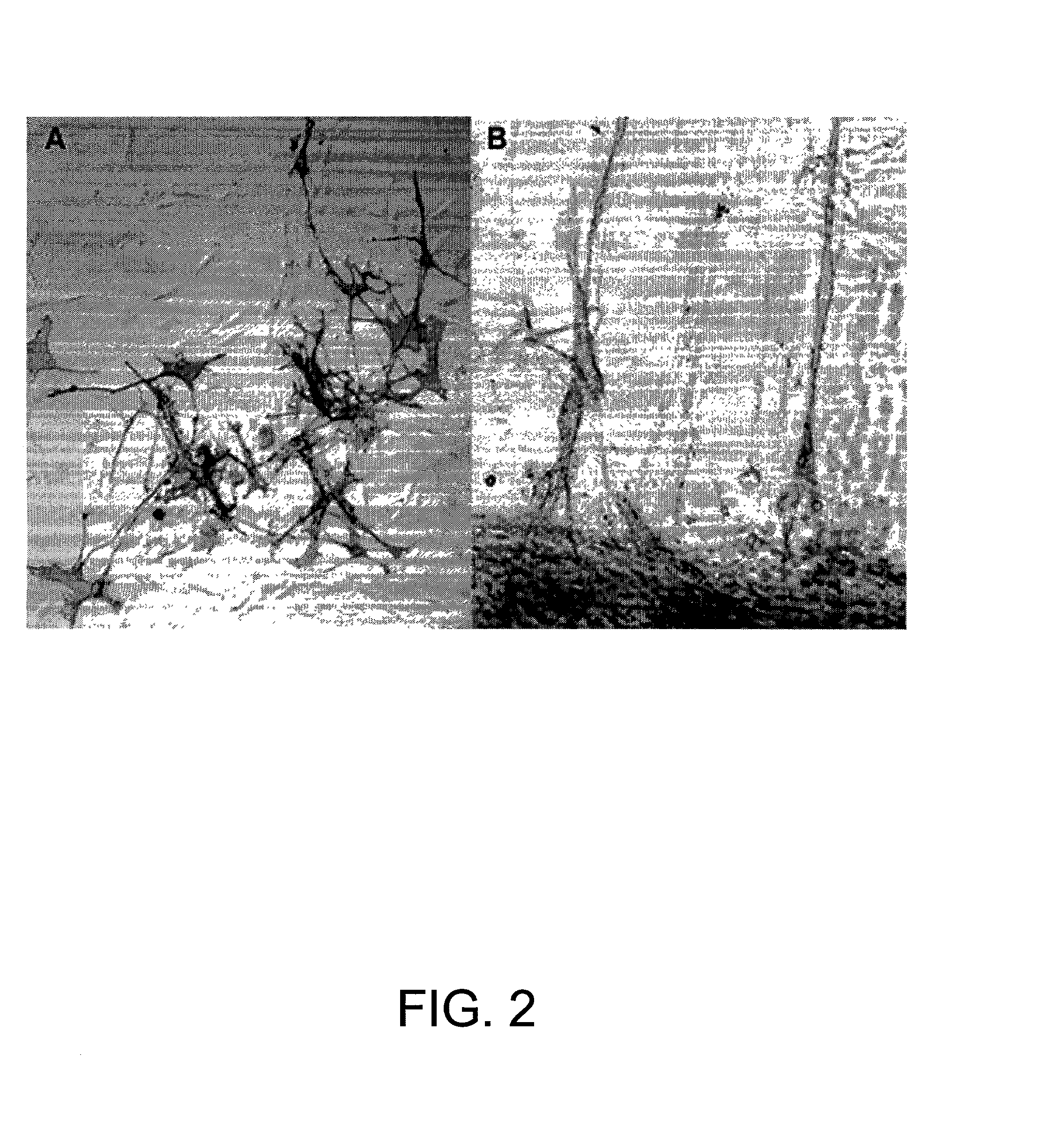 Methods of preparing olfactory ensheathing cells for transplantation