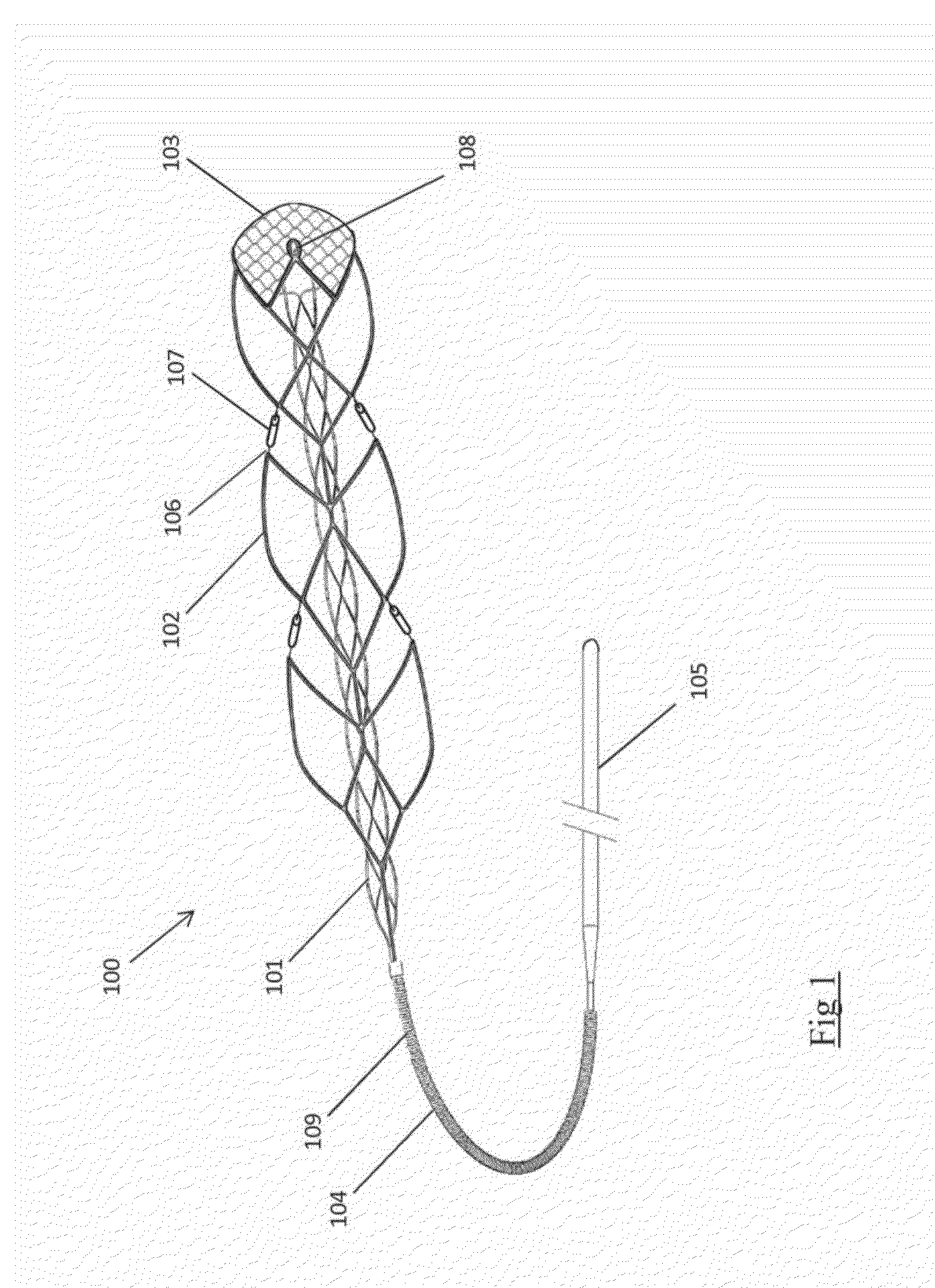 Devices and methods for removal of acute blockages from blood vessels