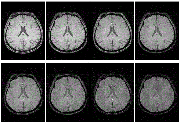 Method eliminating magnetic resonance imaging (MRI) gradient echo sequence odd-even phase difference