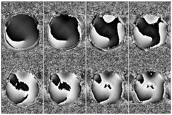 Method eliminating magnetic resonance imaging (MRI) gradient echo sequence odd-even phase difference