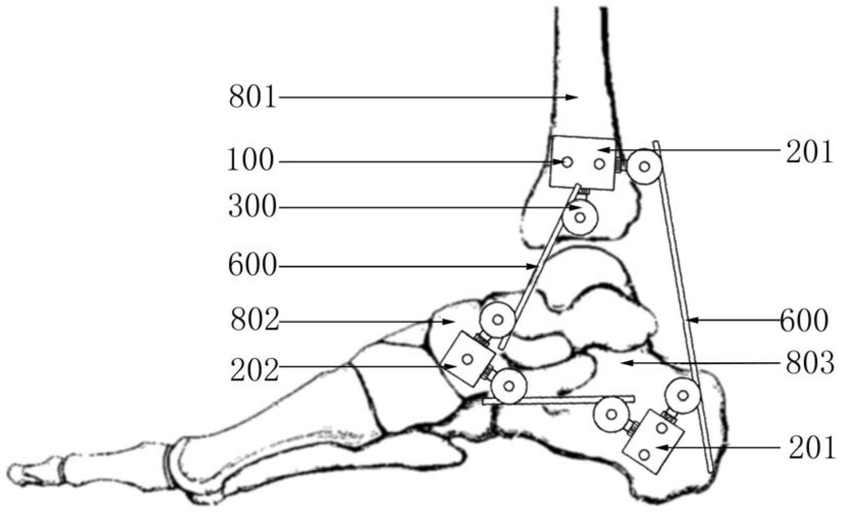 Frame-type external fixator