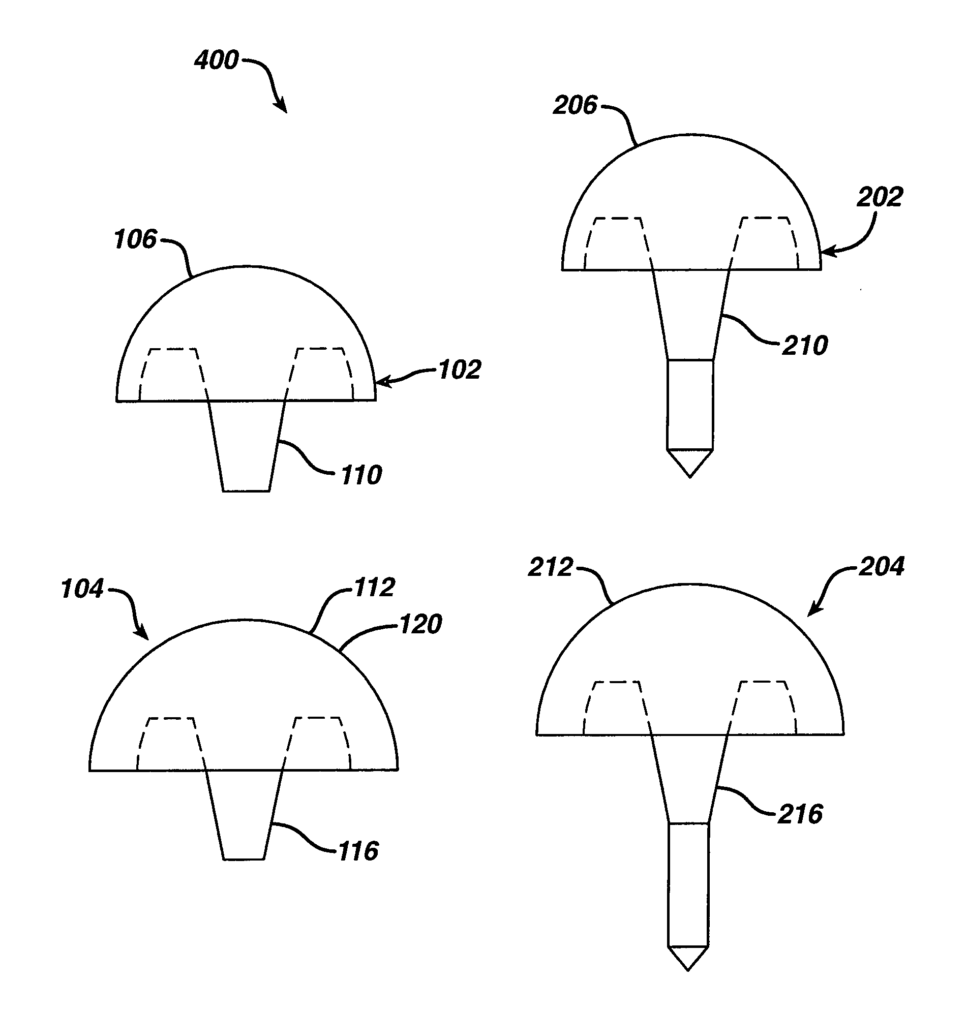 Prosthetic implant, trial and associated method