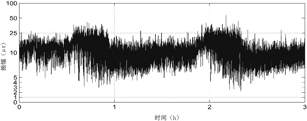 AEEG signal image feature reconstruction, representation and extraction method