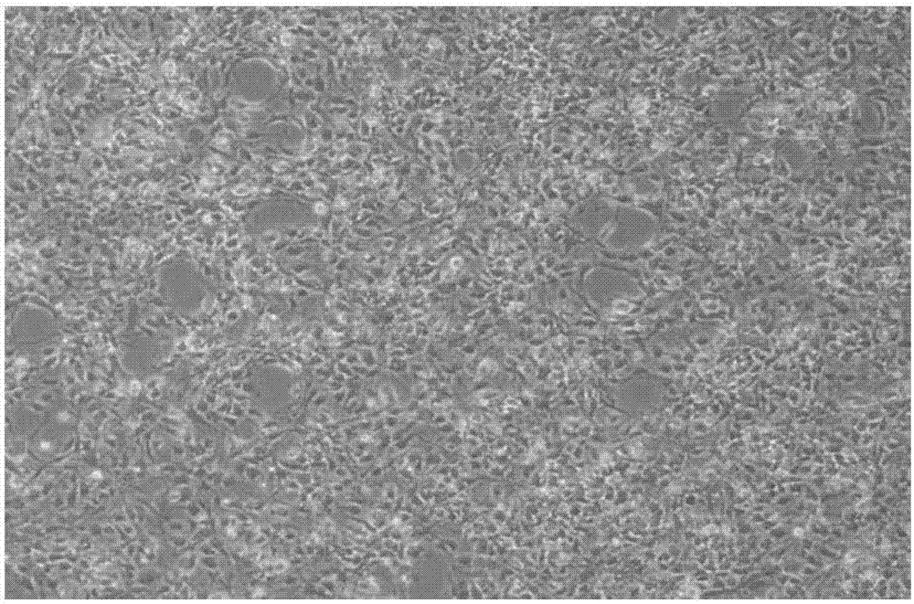 Adherent culture method of neural stem cells