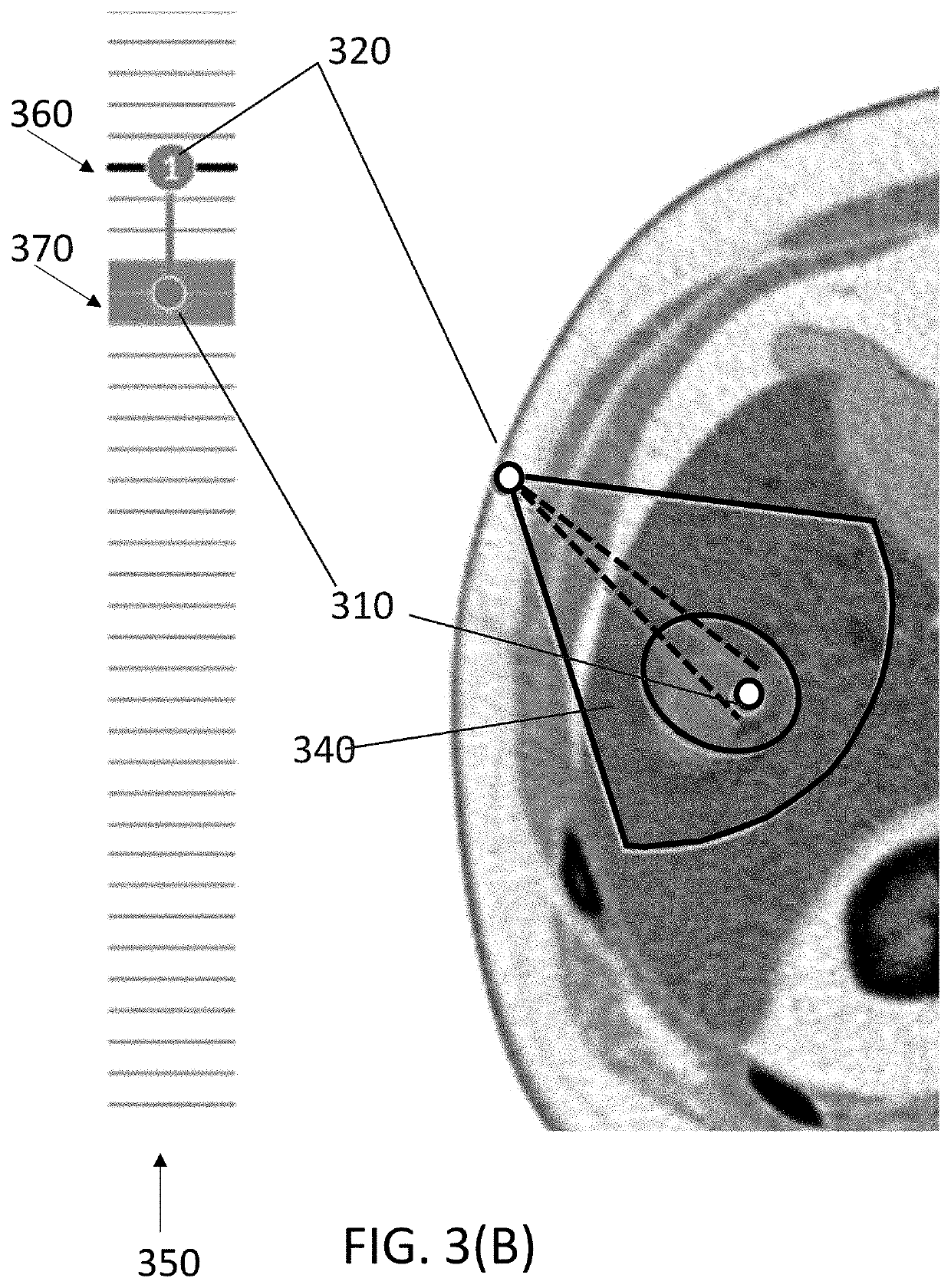 Visualization of three-dimensional image data on a two-dimensional image