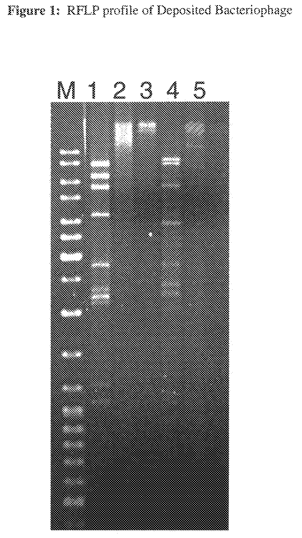 Clostridium perfringens bacteriophage and uses thereof