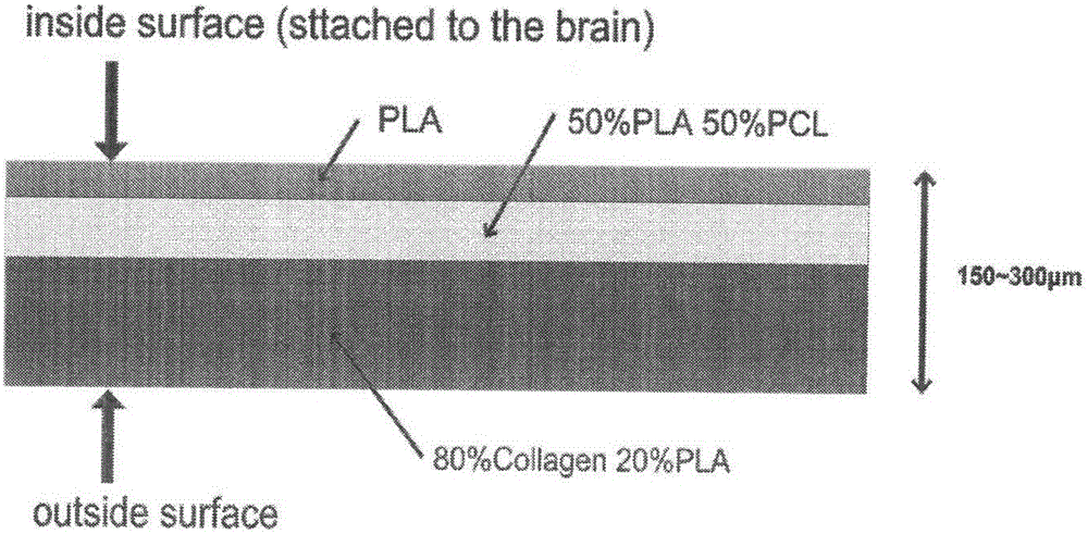 Multi-layer electrospun membrane and use thereof