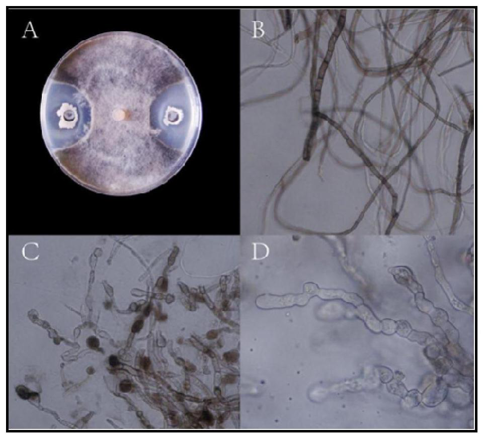 Bacillus amyloliquefaciens l-1 against pear fruit diseases and its application