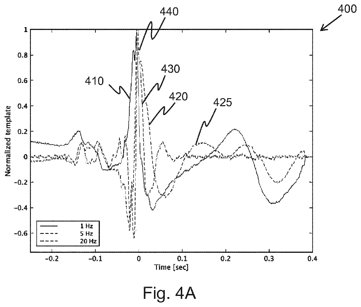 Methods and system for processing an emg signal