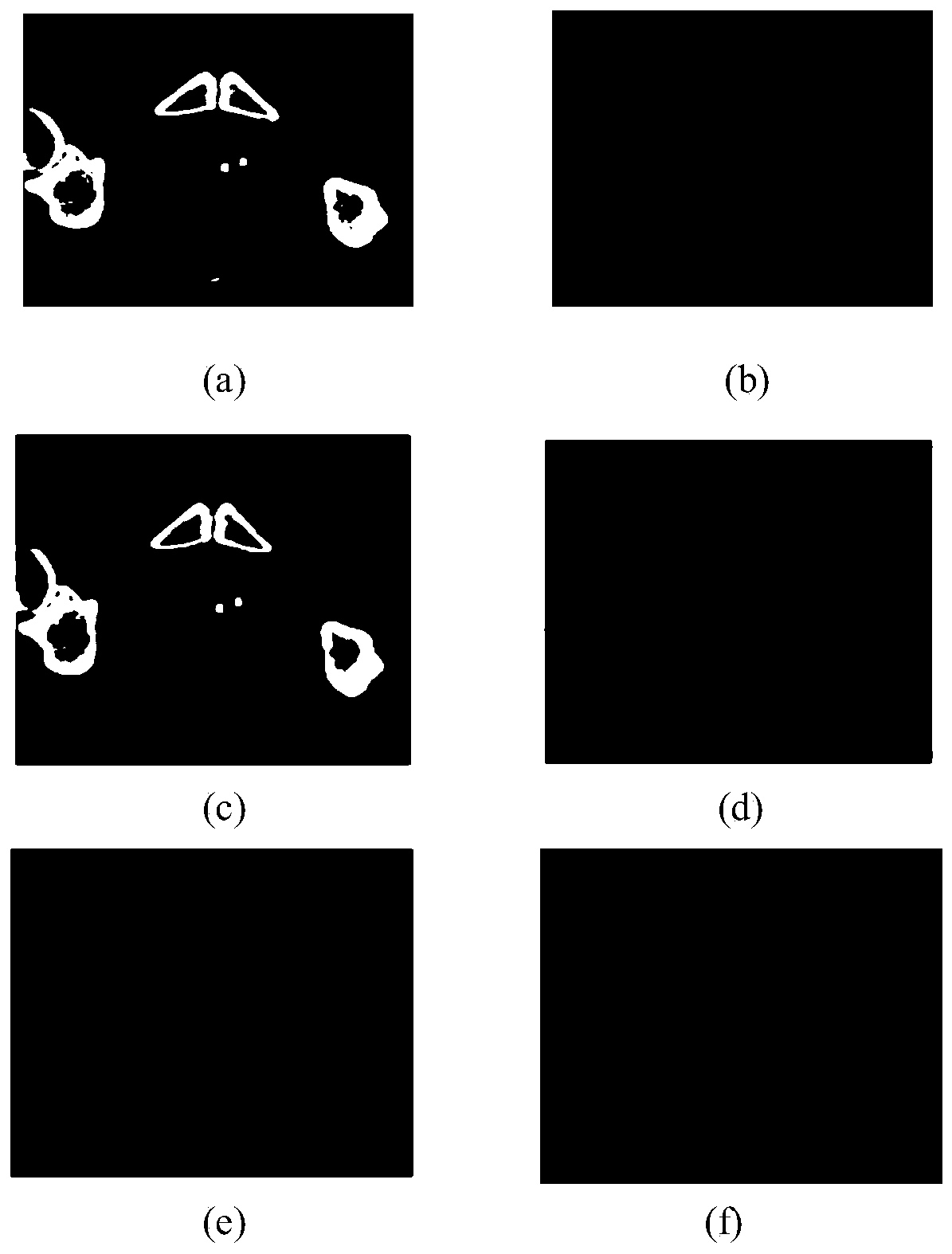 Prostate image registration system and method based on automatic segmentation and pelvis alignment