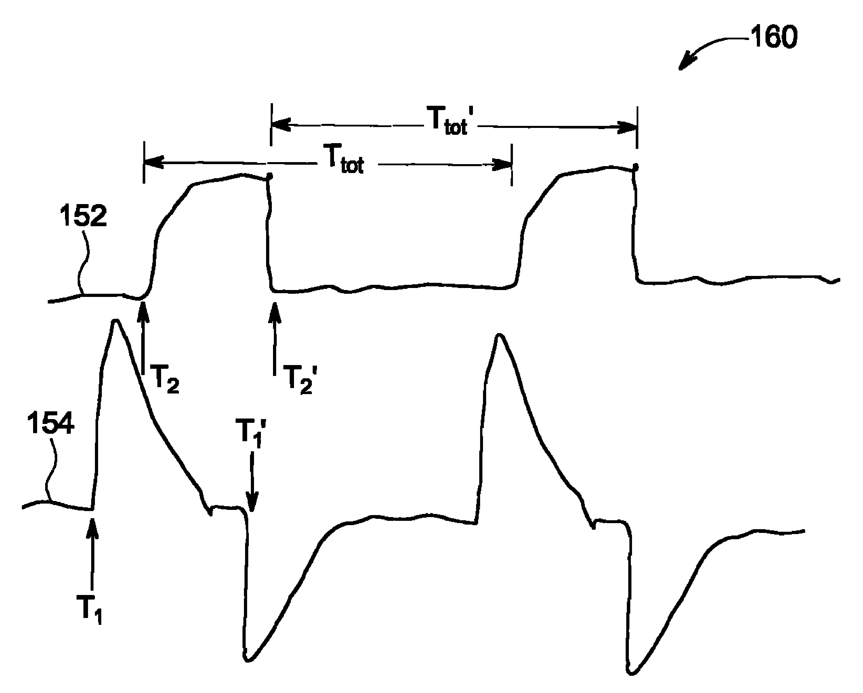 Ventilator sychronization indicator