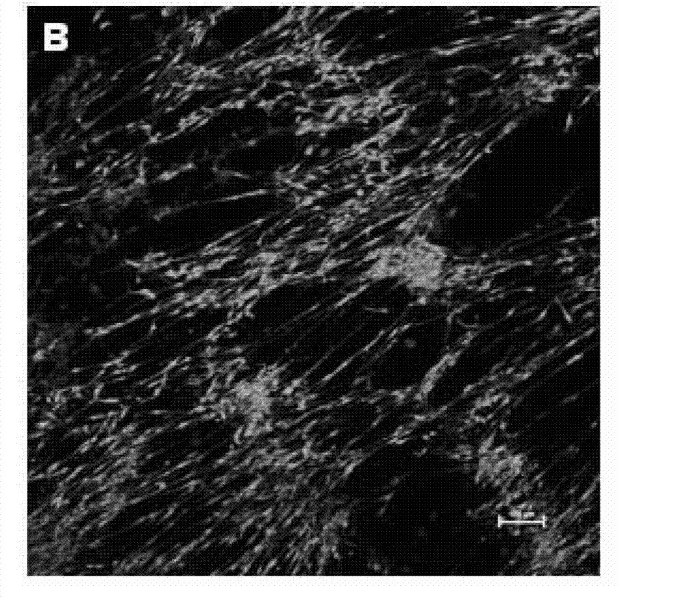 Neural restoration promoting material as well as preparation method and application thereof