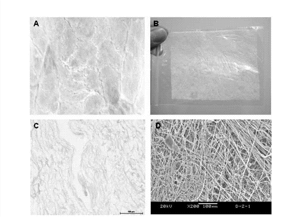 Neural restoration promoting material as well as preparation method and application thereof