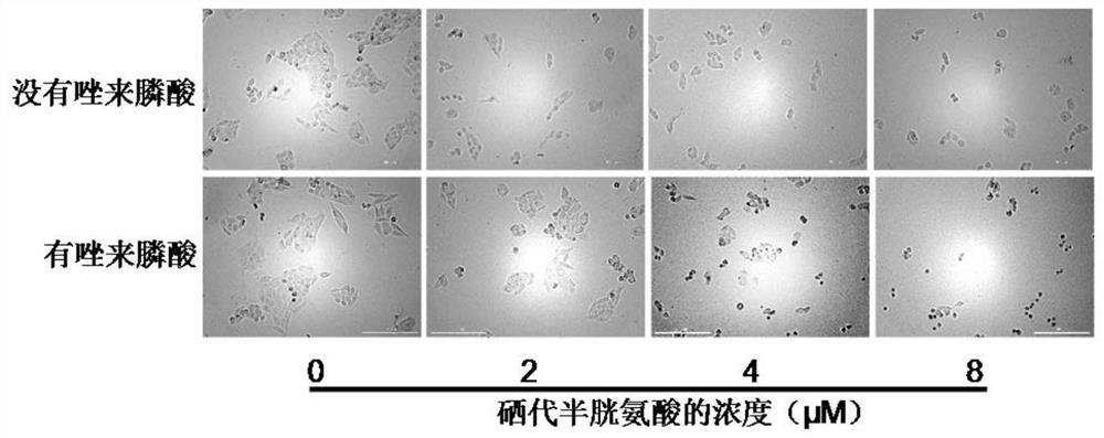 Application of combination of zoledronic acid and organic selenium compound in the preparation of antitumor drugs