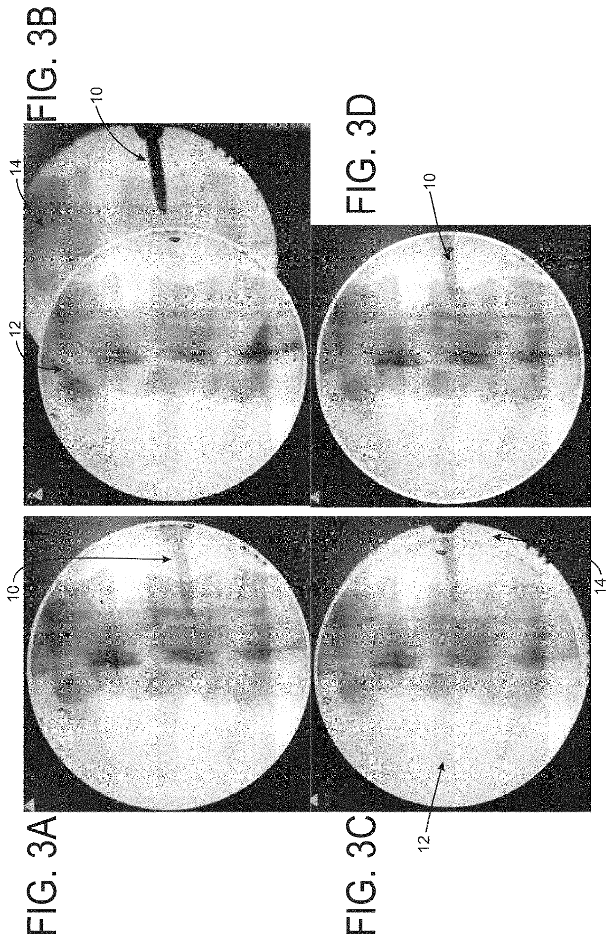 Imaging system and method for image localization of effecters during a medical procedure