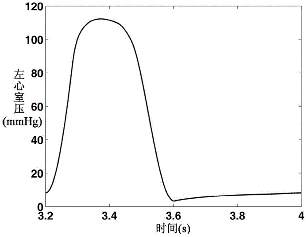 A digital simulation method of blood regurgitation in mitral regurgitation