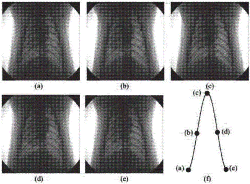 Living body CT scanning control method based on segmented speed regulation