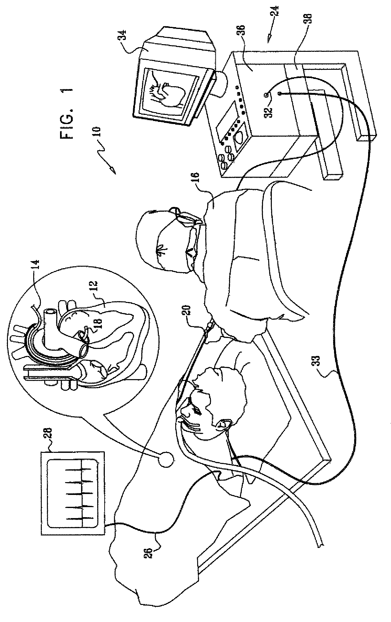 Filter for simultaneous pacing and ablation