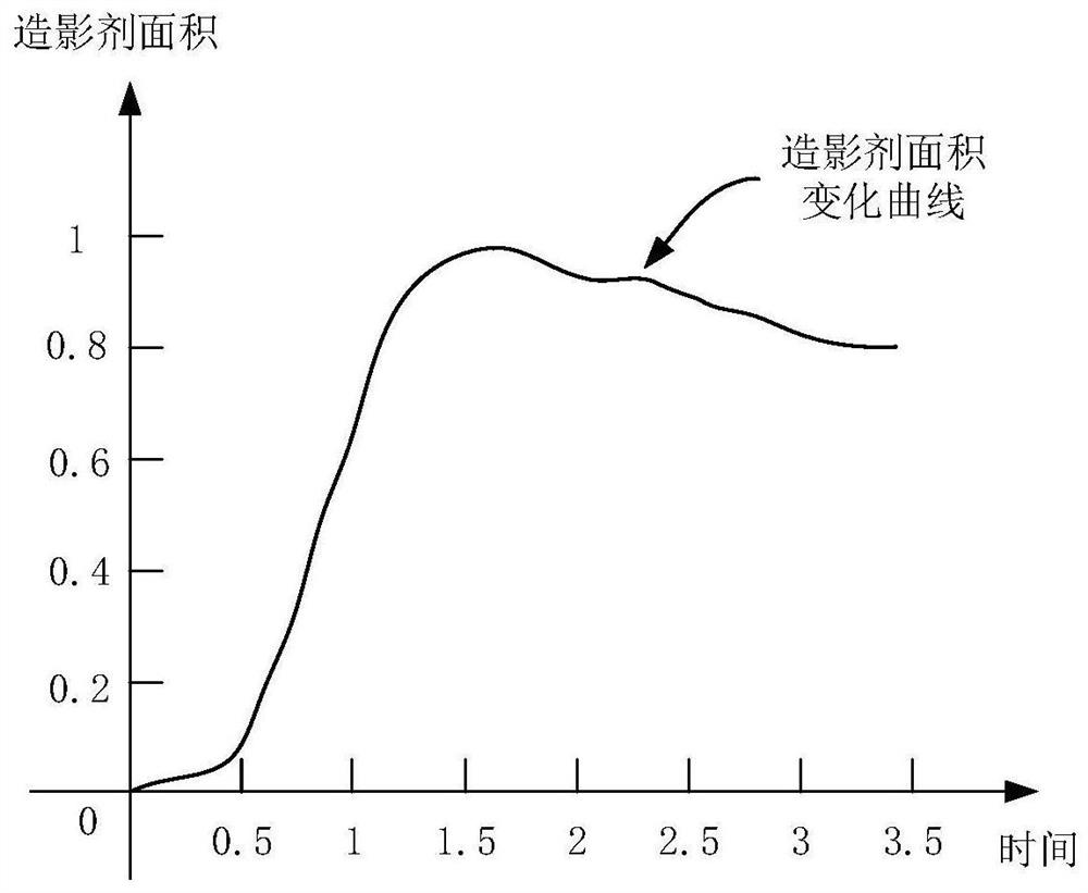 Coronary microvascular resistance index calculation device and method