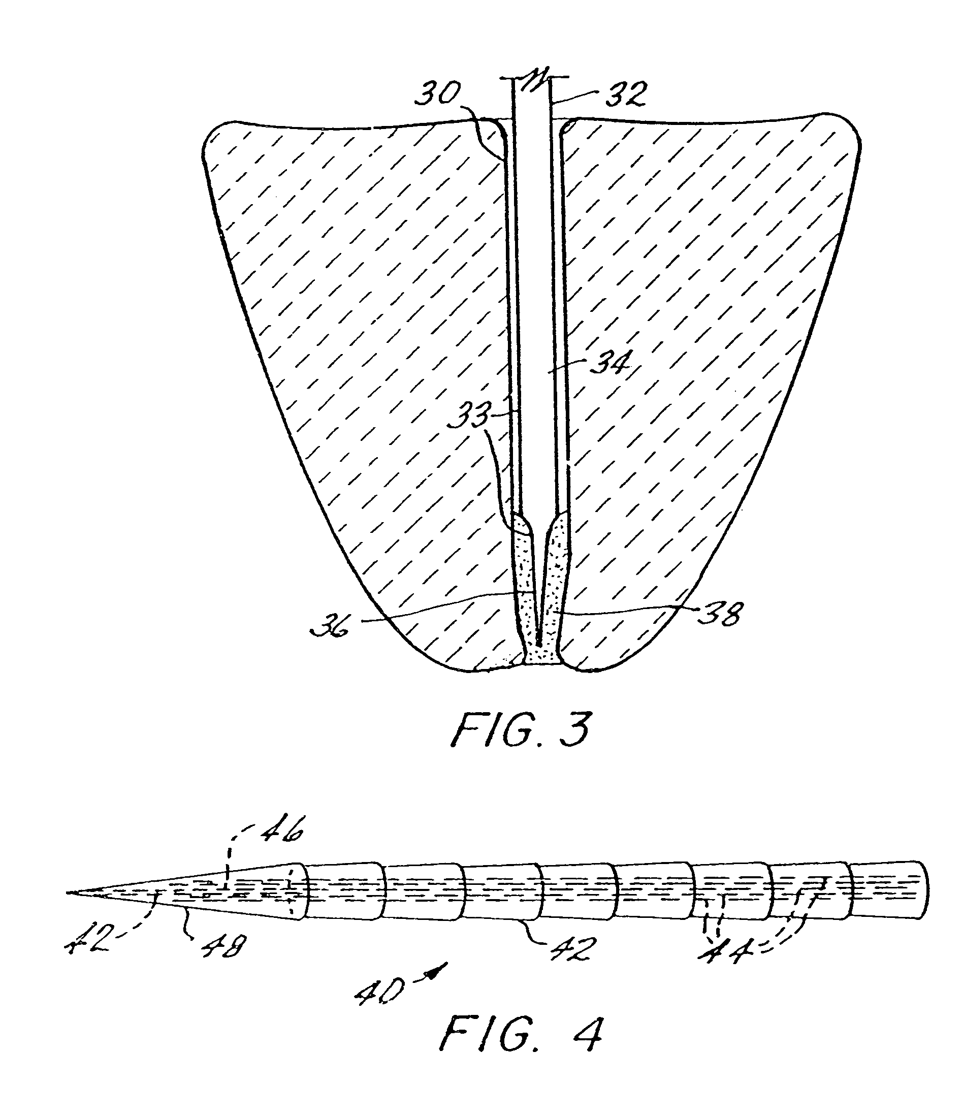 Endodontic post and obturating system