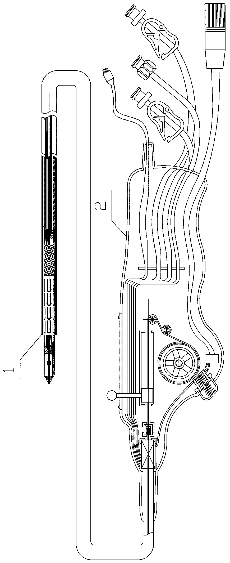 One-way thrombus removal device