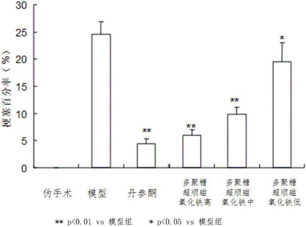 Application of glycan superpara magnetism ferric oxide to preparation of medicine for treating cardiovascular disease