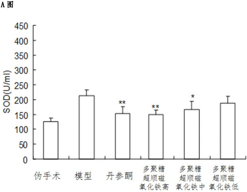 Application of glycan superpara magnetism ferric oxide to preparation of medicine for treating cardiovascular disease