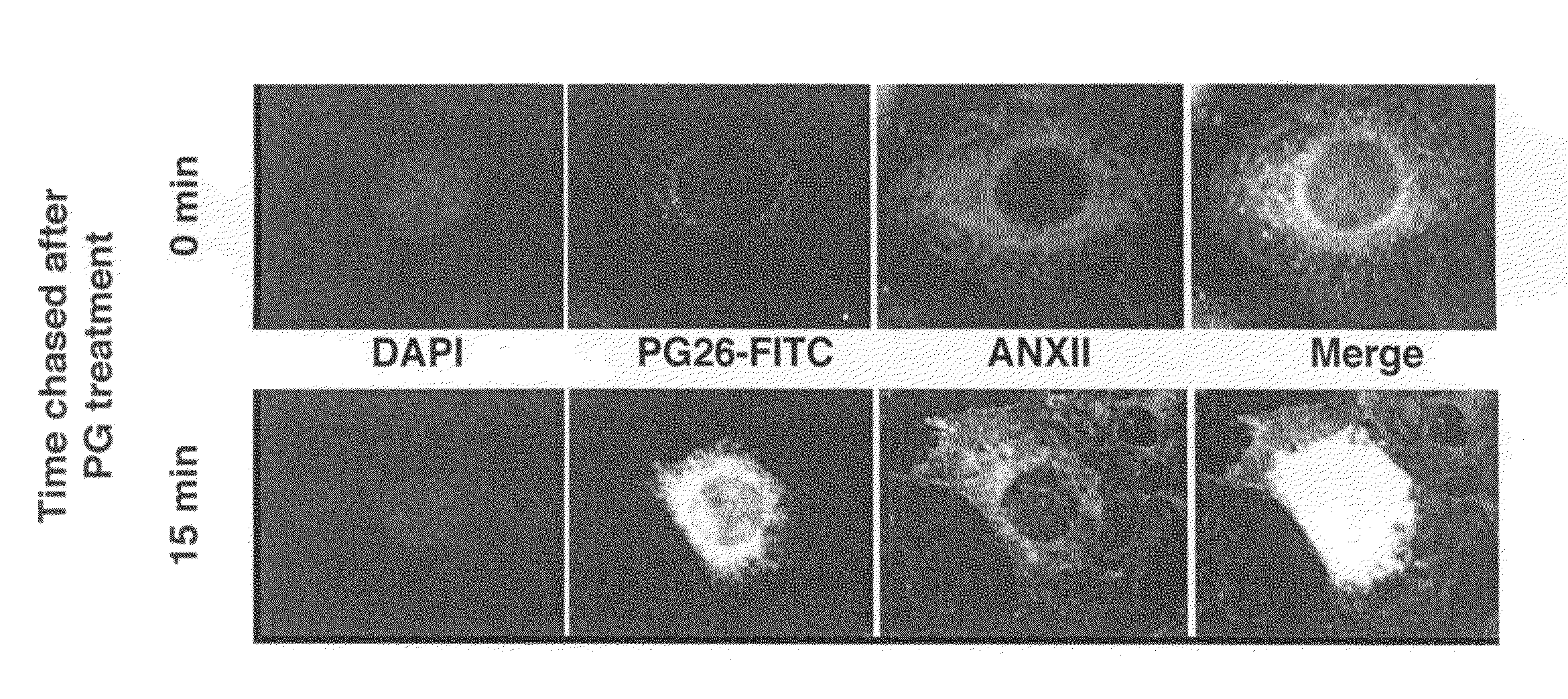 Diagnosis and treatment of epithelial cancers using labeled/conjugated progastrin peptides