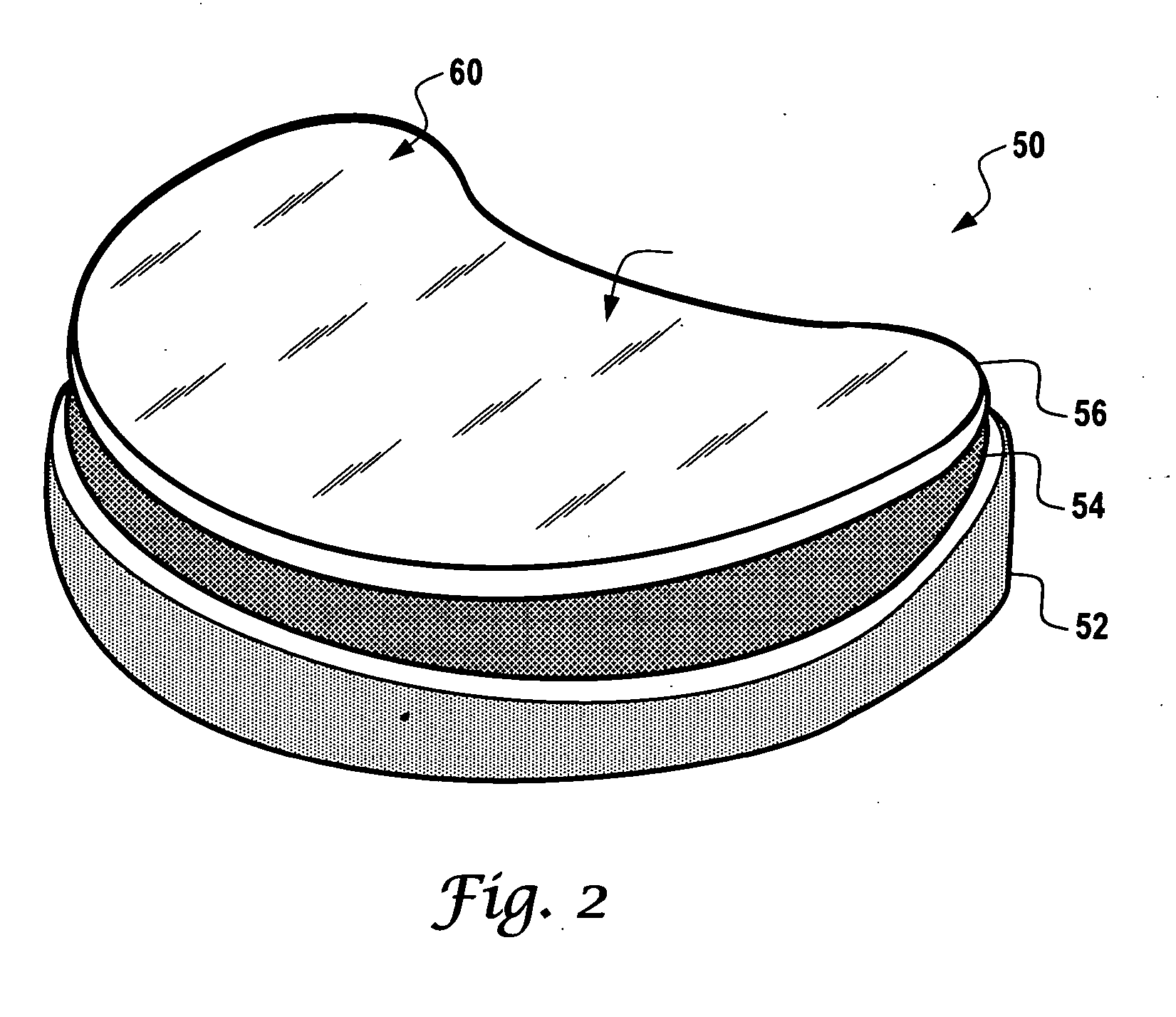 Artificial prosthesis