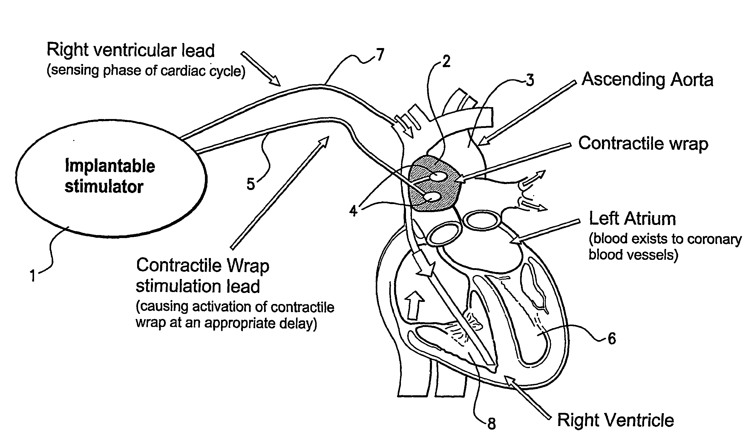 Method and Apparatus for Treating a Heat Condition