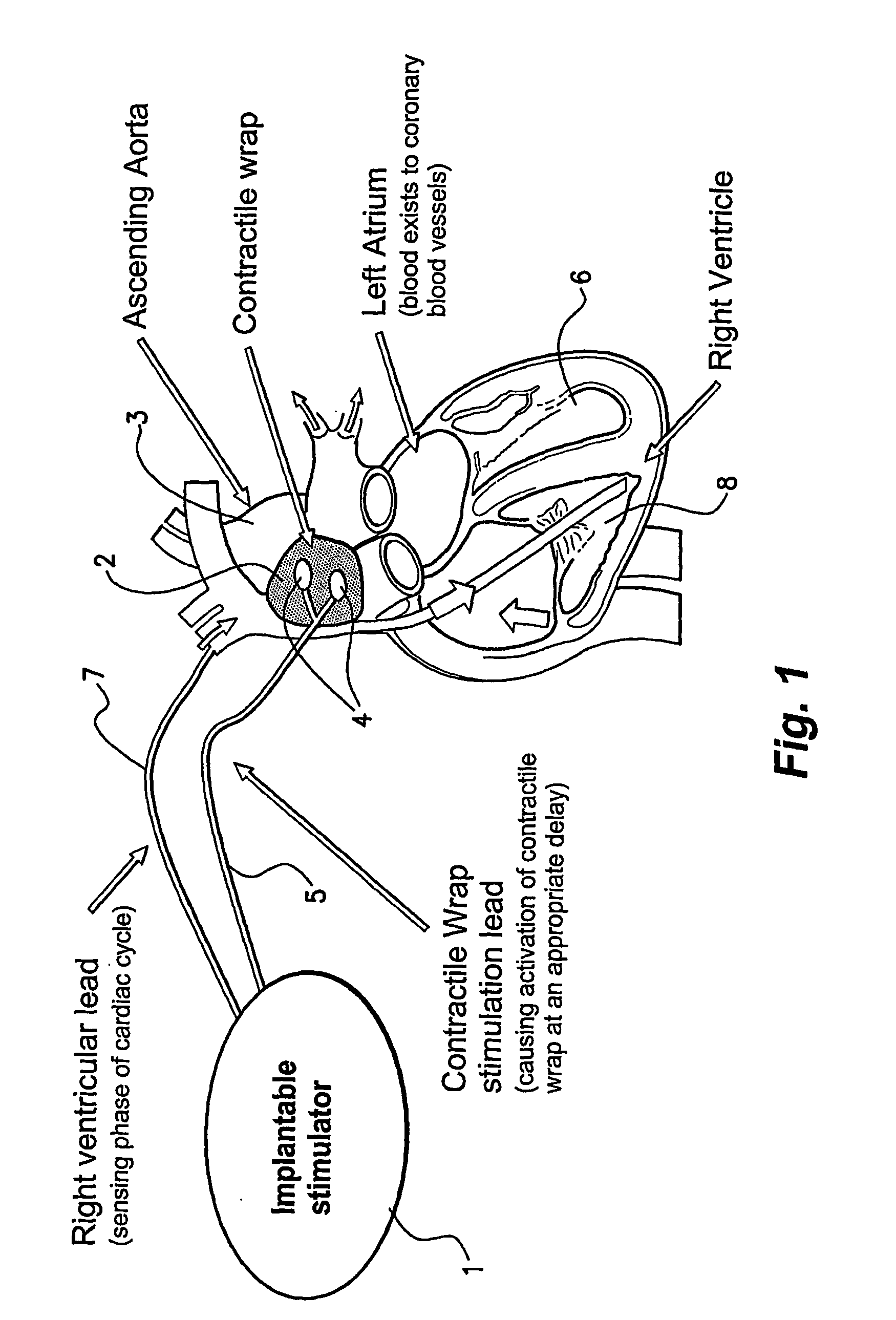 Method and Apparatus for Treating a Heat Condition