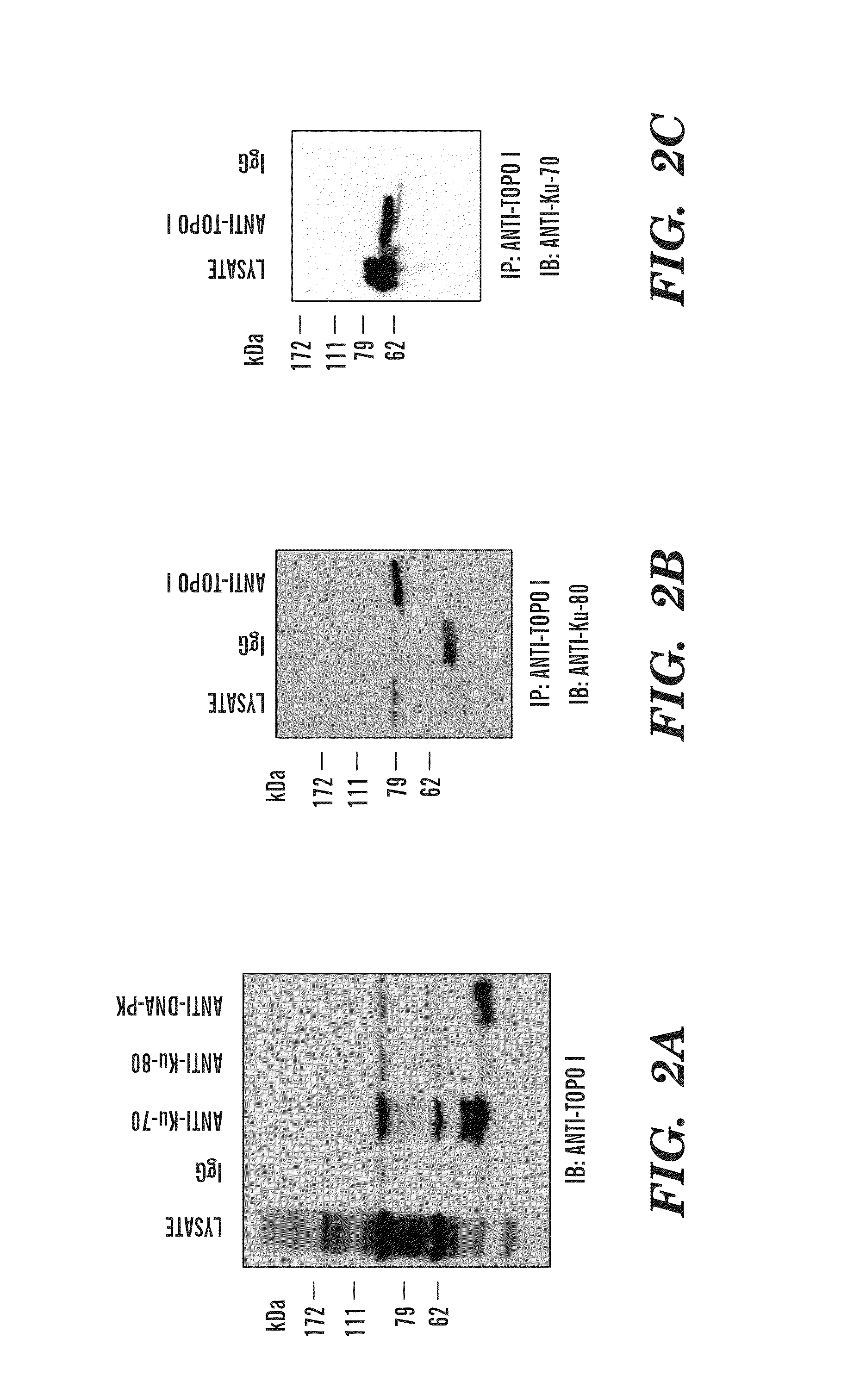 Predictive marker for topoisomerase I inhibitors