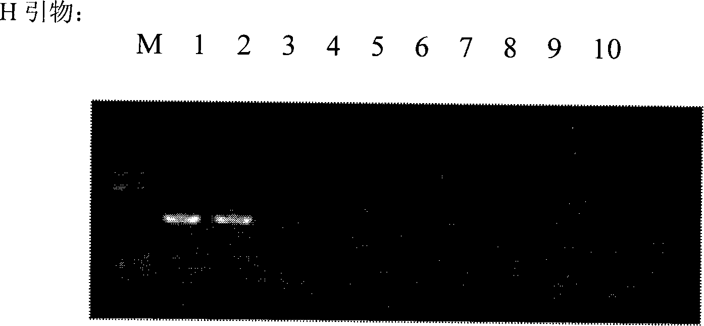 Cryptosporidium and cryptosporidium parvum specific PCR detecting reagent kit and detecting method