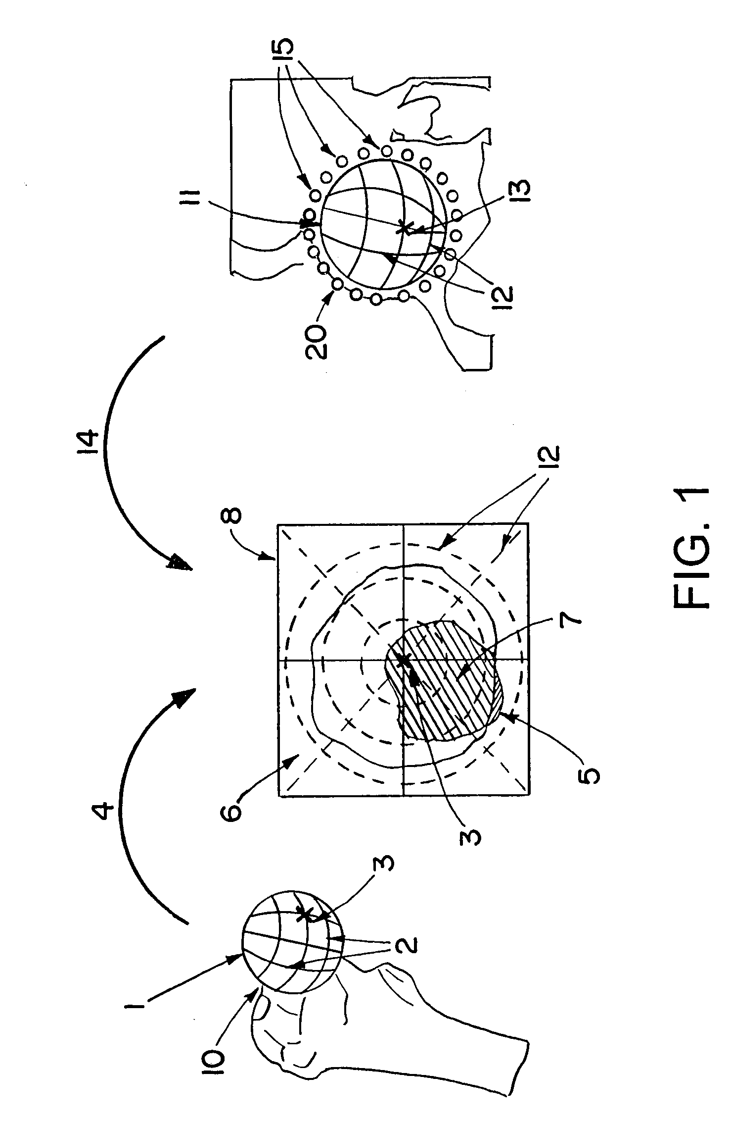 Computer-assisted joint analysis using surface projection