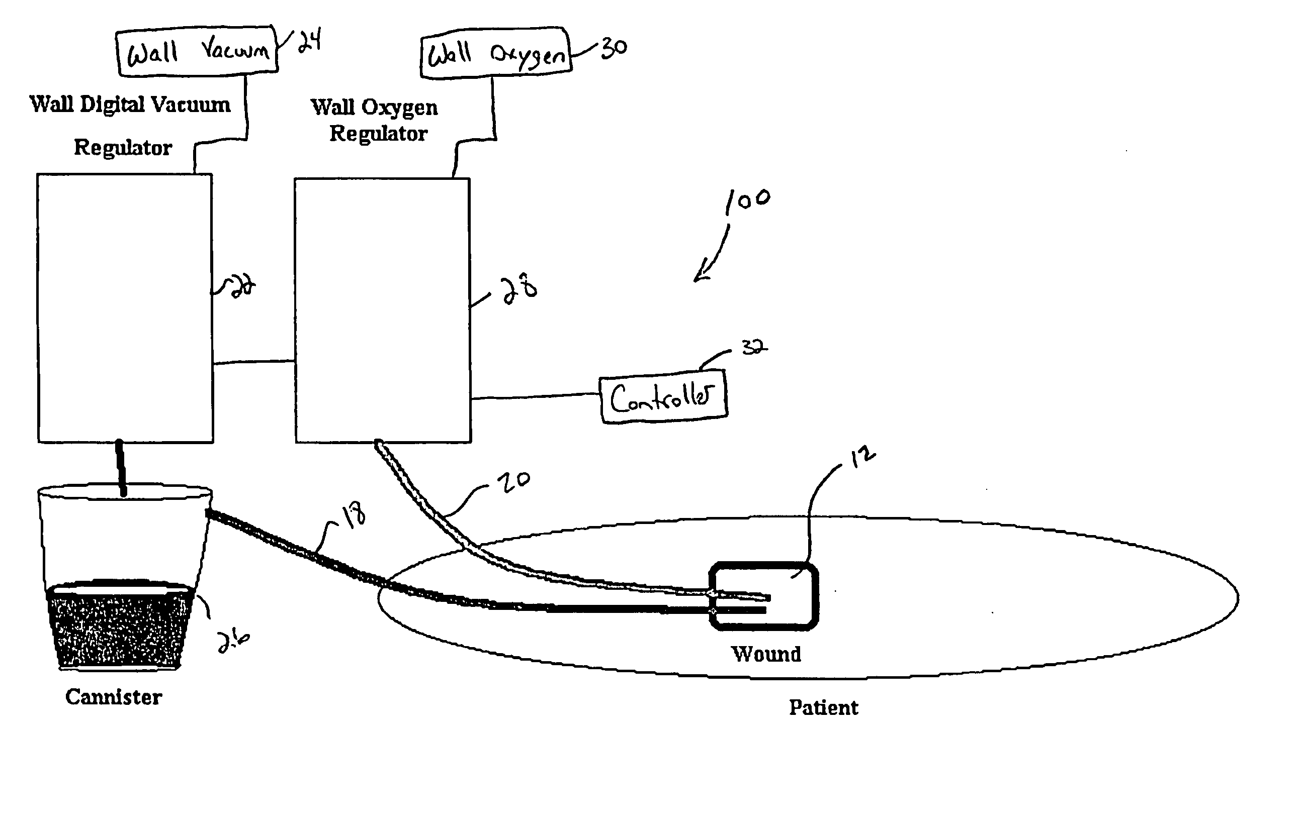 Wound care apparatus