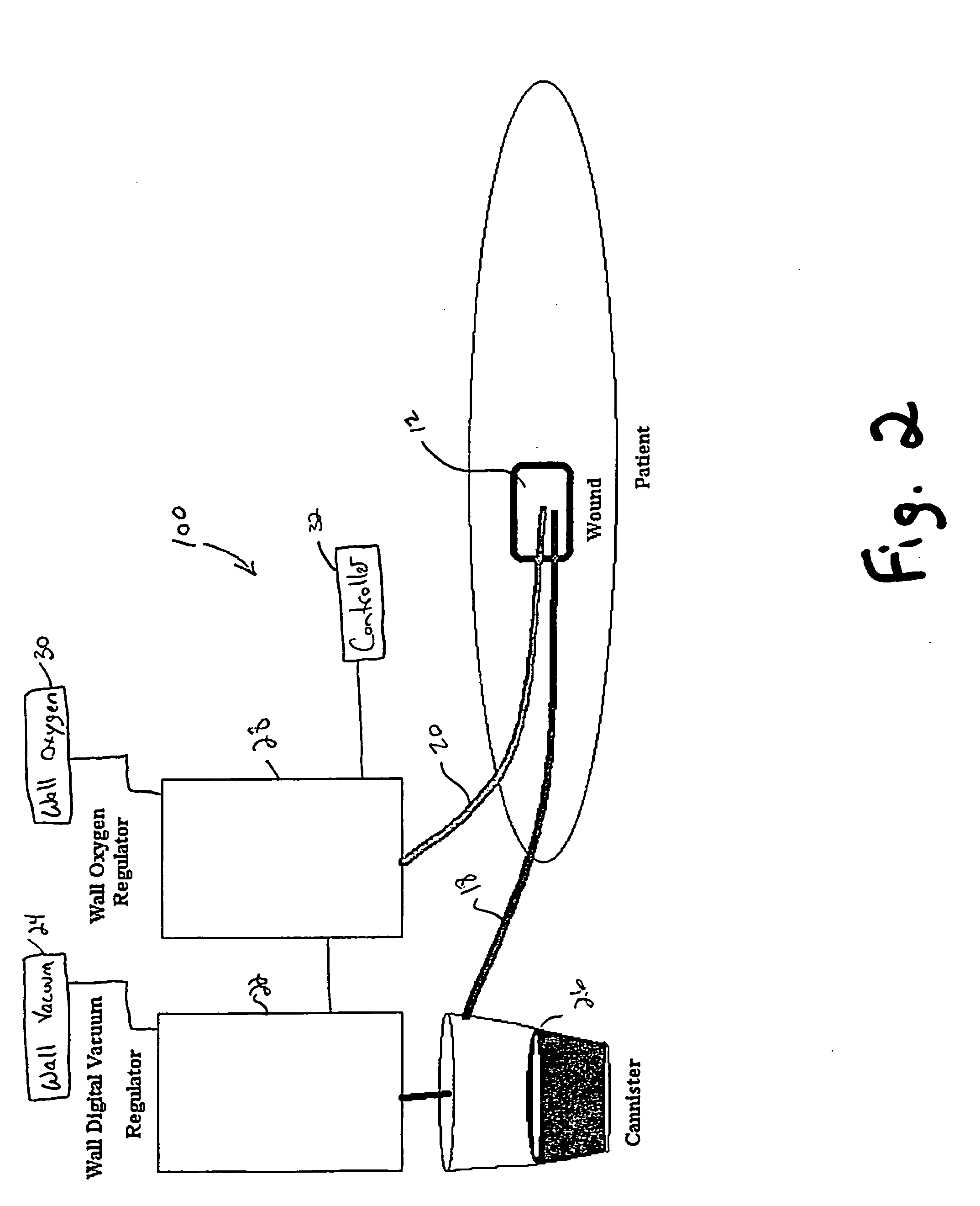 Wound care apparatus