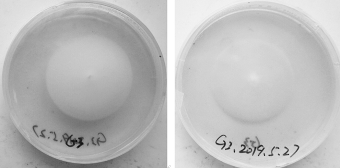 An endophytic fungus that can enhance casuarina acid phosphatase activity under low phosphorus environment