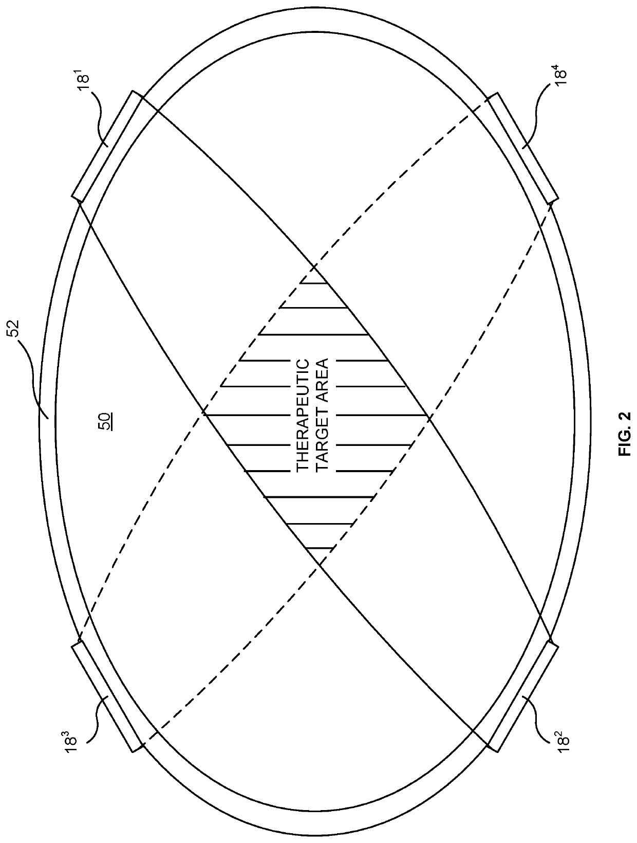 Medical wound covering employing electrical stimulation to control blood flow