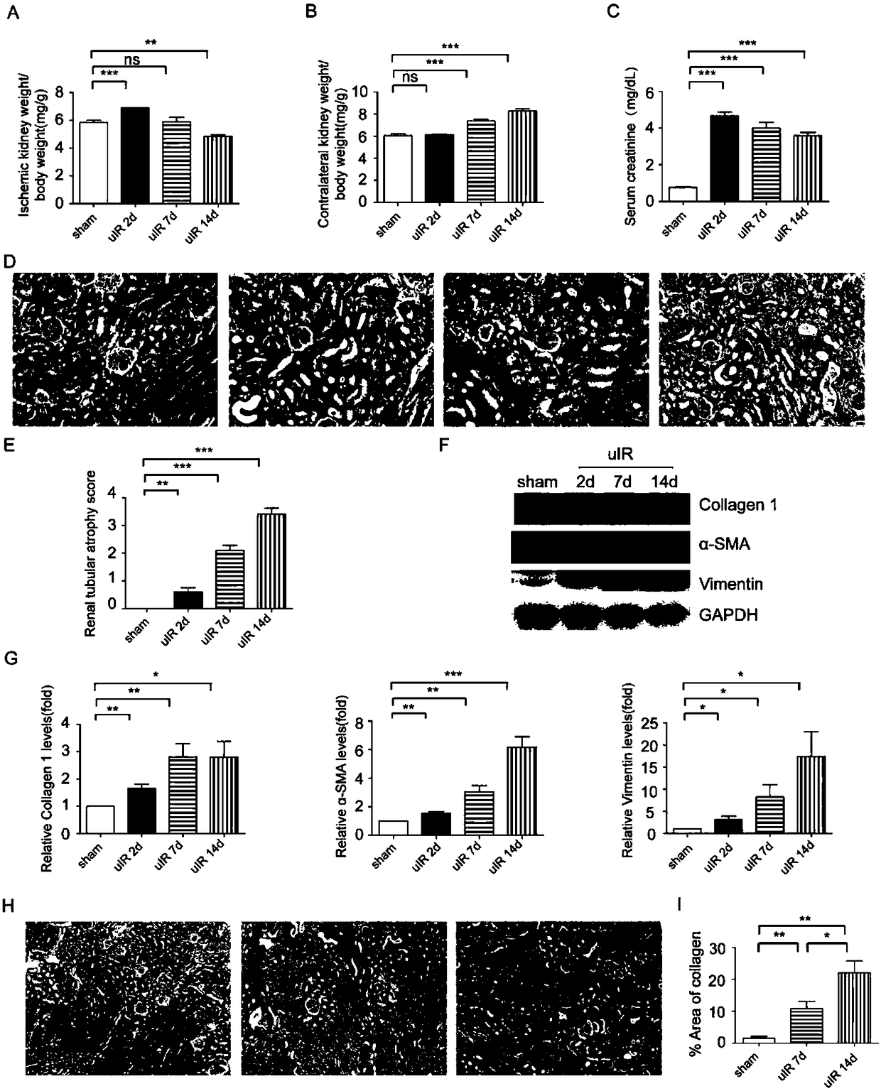 Application of Tauroursodeoxycholic acid (TUDCA)