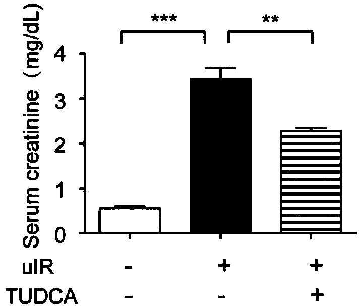 Application of Tauroursodeoxycholic acid (TUDCA)