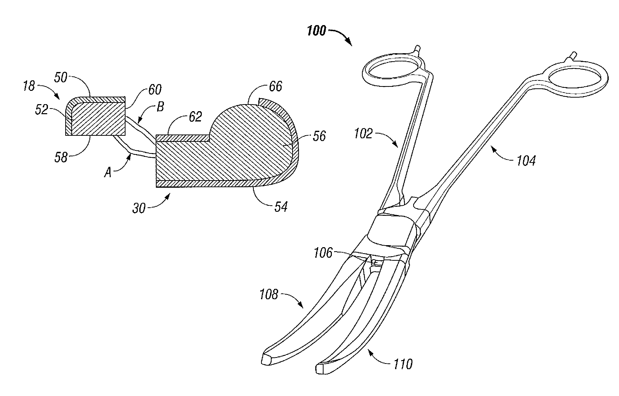 Bipolar scissors for adenoid and tonsil removal