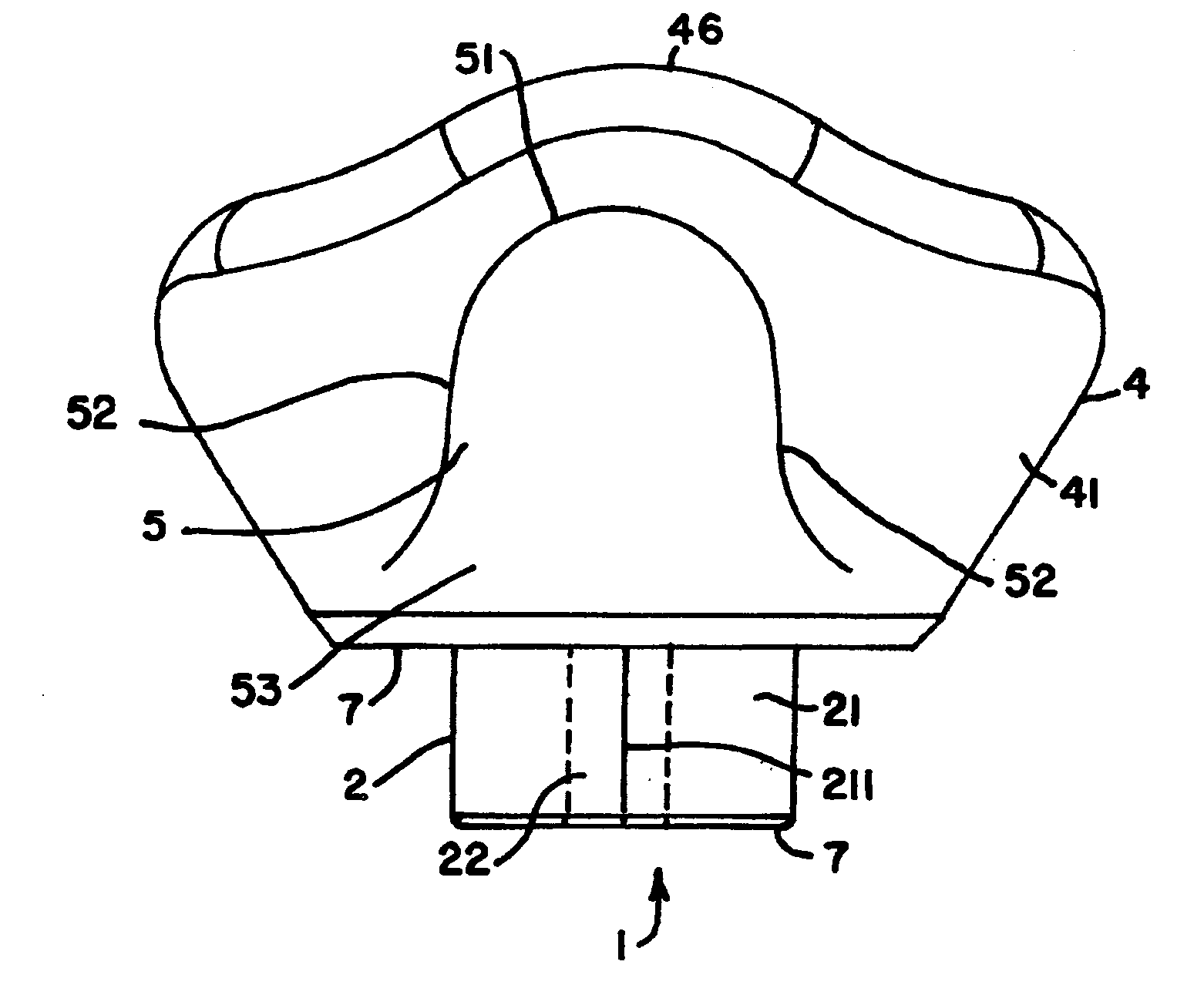 Healing abutment system for bone contouring